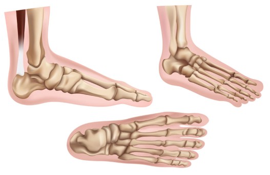 Arthroscopic Foot Fusion by OrangeCountySurgeons
